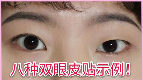 什么是双眼皮全切 d43b3faadae21b98153d5c8e158c7f77bd8cc438.jpg@480w_270h_1c