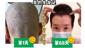 剃了光头怎么让头发长得快 d4c439b872908470f4b8b56c8cf965ce4432082e.jpg@280w_158h_1c_100q.jpg