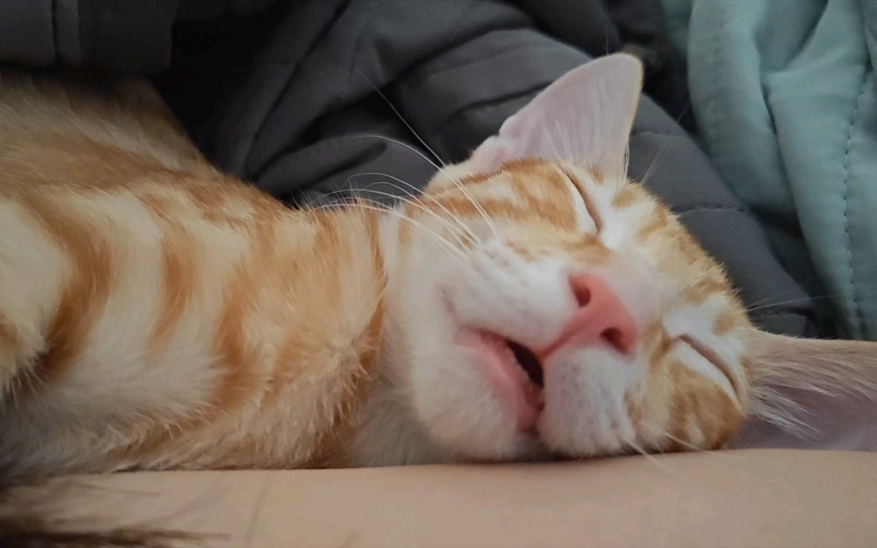 孩子口呼吸怎么治