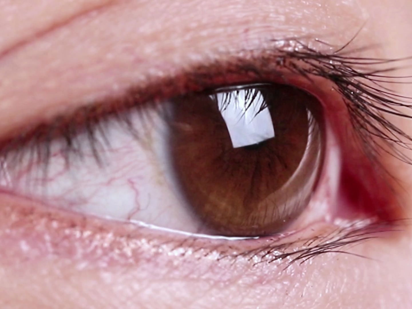 这是真正的东方褐色的眼睛，很漂亮的眼睛。虹膜区很大，只是眼白血丝多了不少