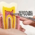 什么情况下牙齿要做根管治疗？真实还原根管治疗过程