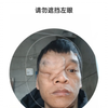 建议改善人脸系统，多一个认证渠道，给几十万同类患者同胞一个鼓励