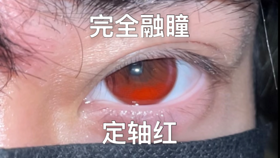 居然完全融瞳？！太适合白毛了…