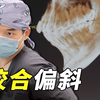 咬合偏斜=全身关节出问题？患者从加拿大回国专门找坦院面诊