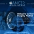 最强医学公开肿瘤学影像数据库--TCIA