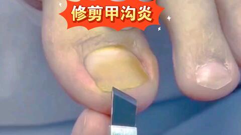 d9d6385ec0a6cb244b303be9596daf629c1cc711.jpg@480w_270h_1c