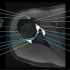 肩关节MRI解剖-影像解剖系列
