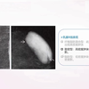 15.常见乳腺良性病变的乳腺X线表现-乳腺X线诊断培训系列