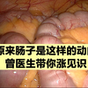 做手术时发现患者肠管在疯狂蠕动，很可能是饿了
