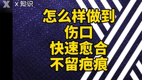 dd061523ce3221b4e77932ffa1e81539cf51396f.jpg@280w_158h_1c_100q.jpg