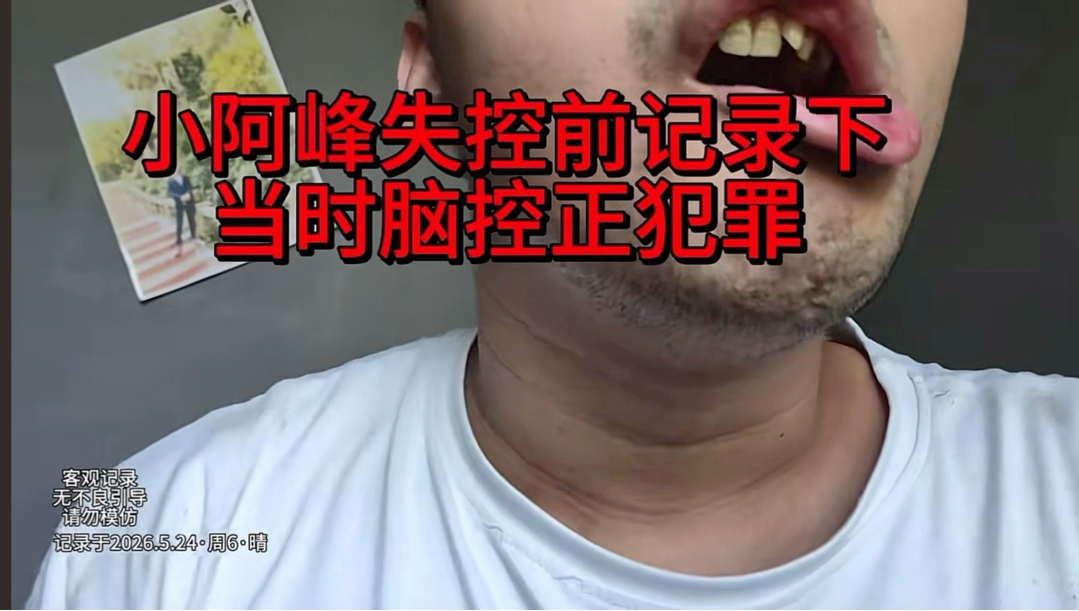 网红小阿峰声称自己被阴谋集团脑控生不如死