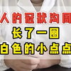 18岁的小男孩冠状沟周围长了一圈小白点，这是怎么回事呢
