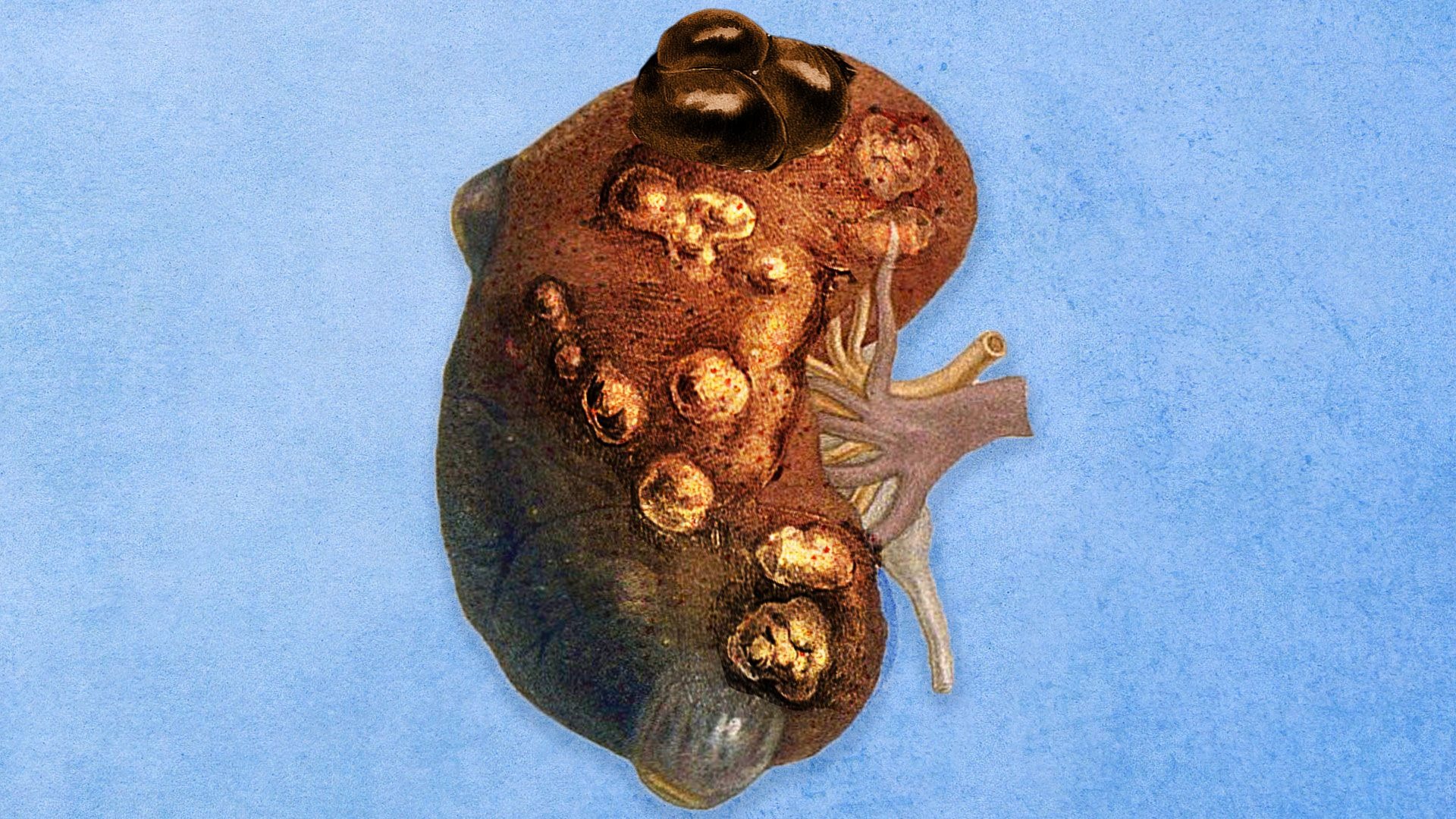 一位男性吞服了一整瓶抗癫痫药，事后却意外揭露了他体内更大的谜团…