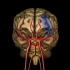 一看就懂，脑梗塞发生过程，3D演示。。