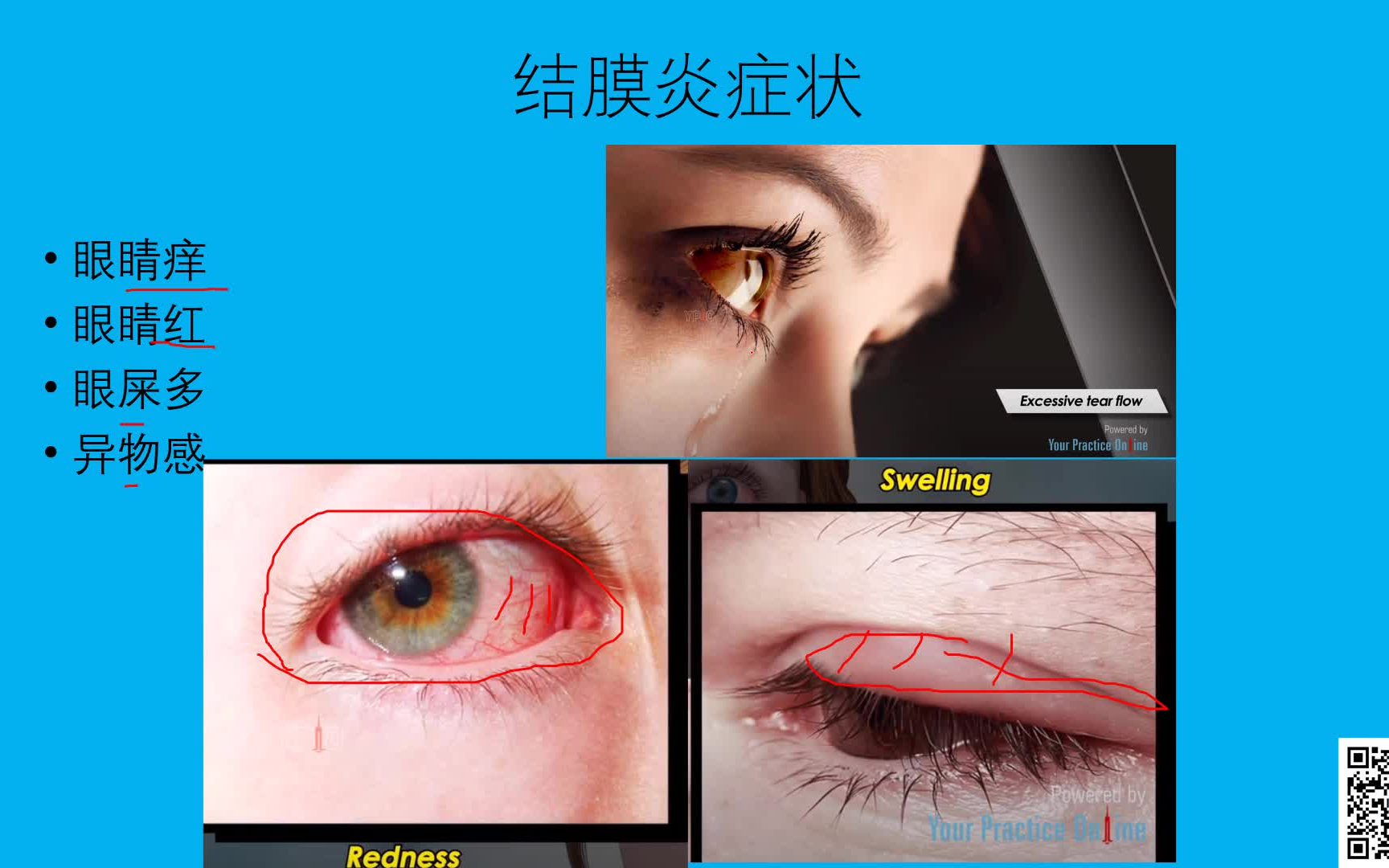 PPT - 结 膜 病 PowerPoint Presentation, free download - ID:6992428