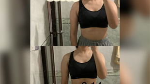 如何瘦肩膀和背手臂 dfb85a6c06a0e5d65ca5dcb8452c488a98e13a83.jpg@310w_174h_1c_100q.jpg