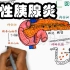 医学生动画演绎 内科学考点 急性胰腺炎