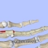 得了狭窄性腱鞘炎怎么办，3D演示。。