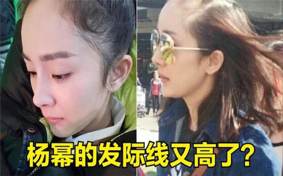 杨幂假发被突然被掀掉,瞬间惊慌匆忙遮脸,网友:发际线又高了!哔哩哔哩bilibili