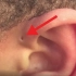 如果你耳朵上有这样一个小洞，那你一定要注意了！@油兔不二字幕组
