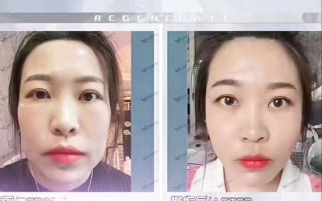 再生美星颜十三线