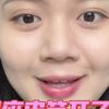 油皮瑕疵皮不试试这个粉底液我真的会伤心！粉底液：嘉利玛虾青素粉底液色号：n02（已经挺白了）肤质：油痘肌，面中油两颊正常