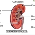 肾结石是如何形成的动画 - 肾结石的原因和症状视频 - 尿流阻塞