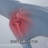 手活动的不能过度，拇指骨关节炎的病因和治疗，3D演示。。