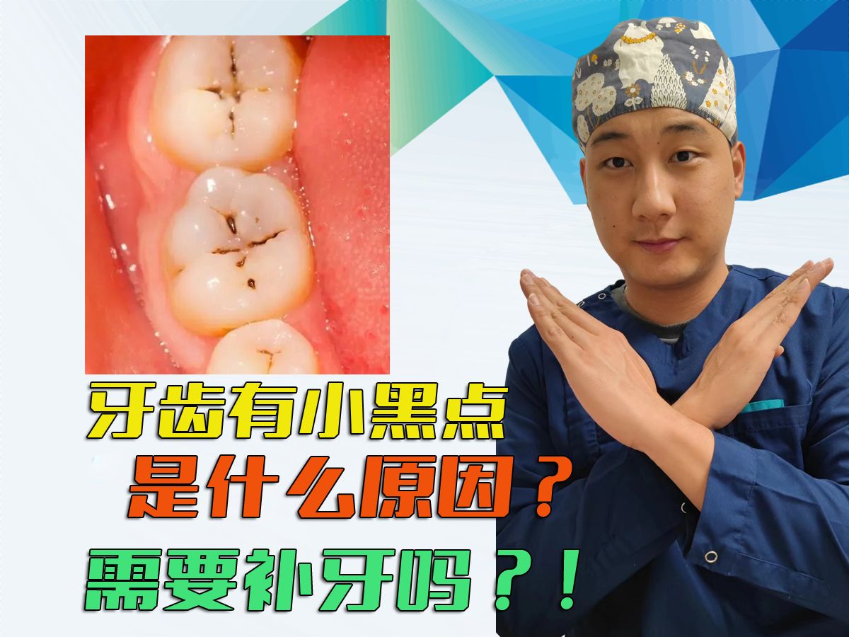 孙自强医生谈：牙齿黑点怎么判断？要不要补牙