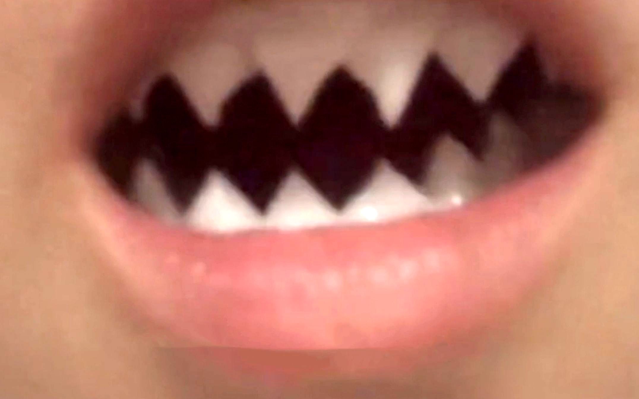 就这牙齿，咬到舌头一定很疼吧