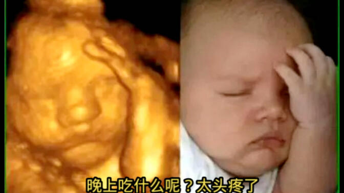 产检的四维图像跟宝宝到底像不像，看看就知道了