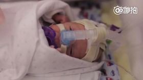 怎么护理早产儿 ea5ec098e3f43d1dd602c7bb59e1b961881a8d77.jpg@280w_158h_1c_100q.jpg