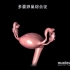3D动画演示多囊卵巢综合征/不孕不育的罪魁祸首
