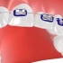 【动画】拔了两颗牙的正畸病例演示