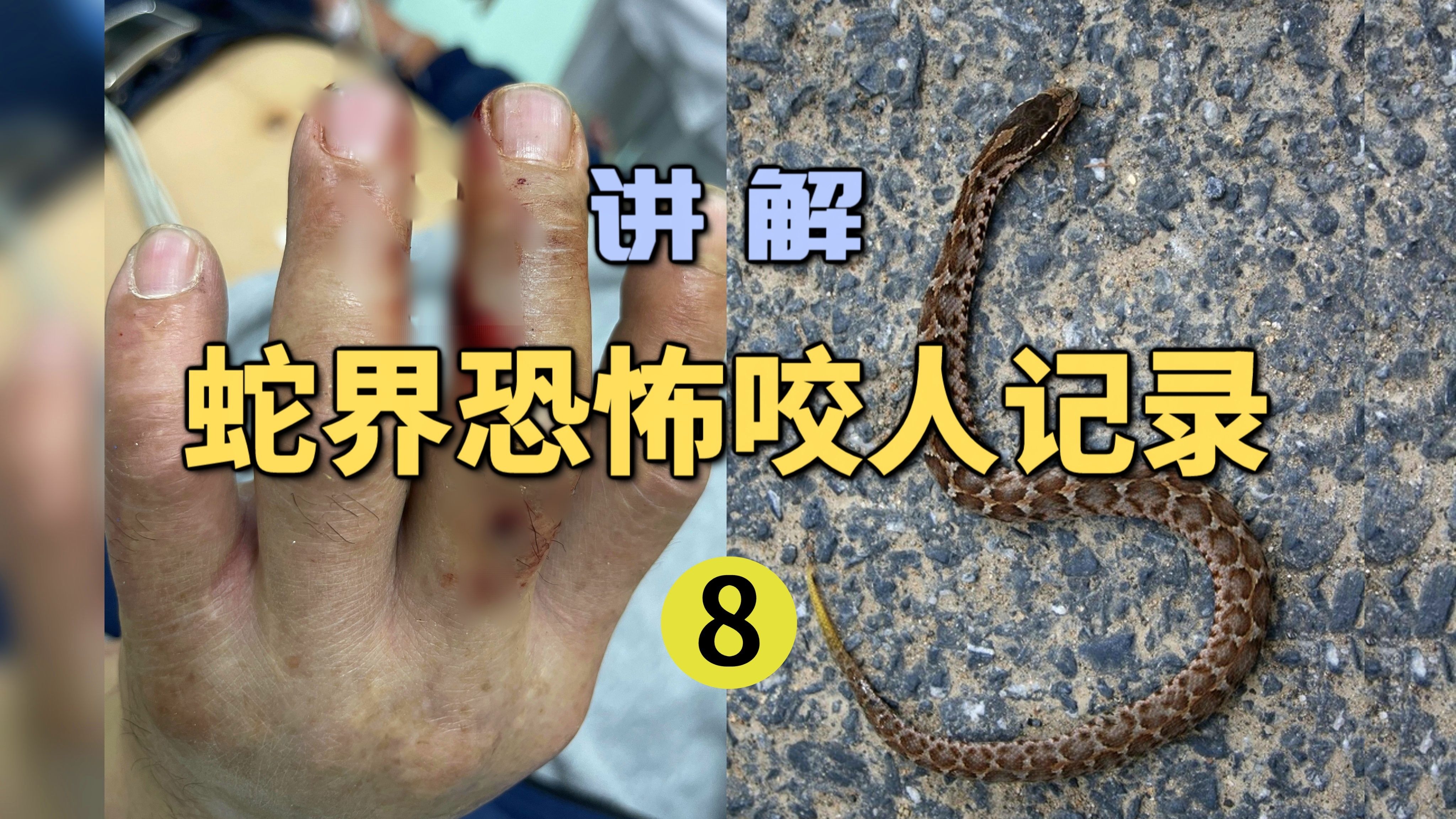 男子喷洒农药时中毒!回家途中又被毒蛇咬伤?实在是太倒霉了!-世界记忆大师龙雅-世界记忆大师龙雅-哔哩哔哩视频