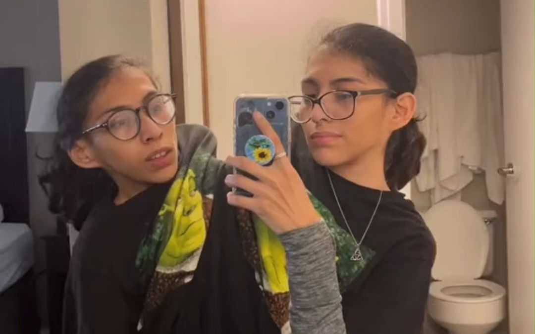 21岁的连体双胞胎姐妹，回答网友们关心的问题