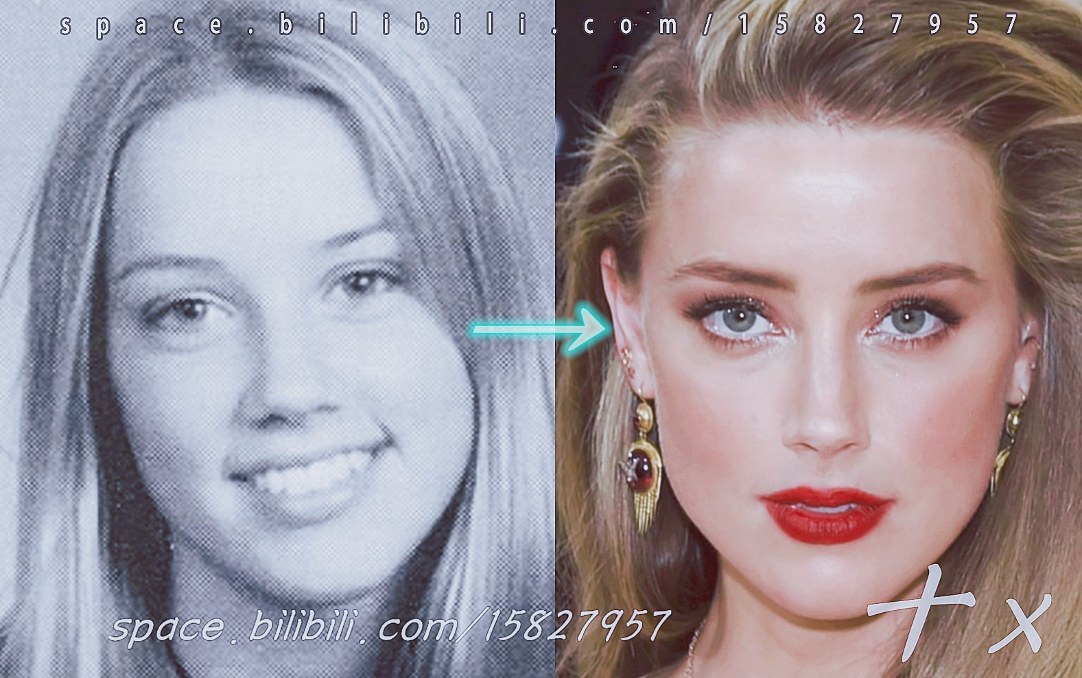 《湄拉整容史》Amber Heard: Cosmetic Surgery and Facial analysis (2020) 高清剪辑.十x