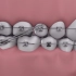 3D动画演绎牙齿矫正