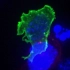 荧光显微镜下的杀手T细胞攻击癌细胞