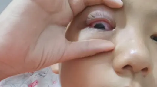 家人们得红眼病了啊啊啊啊啊啊啊啊啊啊啊好难过