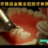 磨牙铸造金属全冠的牙体预备—【口腔】医师实践技能操作视频第二站口腔操作