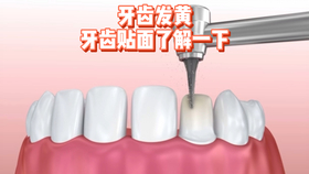 f22cb2acc94f1d609c09f036a7875e745624a1d7.jpg@280w_158h_1c_100q.jpg