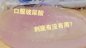 什么水果补维c维b f39d737939dd00dcdad0223a930446b3e227dc4e.jpg@280w_158h_1c_100q.jpg