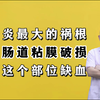 溃疡性结肠炎最大的祸根，不是肠道粘膜破损，而是这个部位缺血