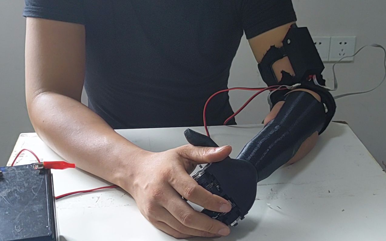 全差速式自适应肌电机械仿生手演示#3d打印低成本自制灵活假肢