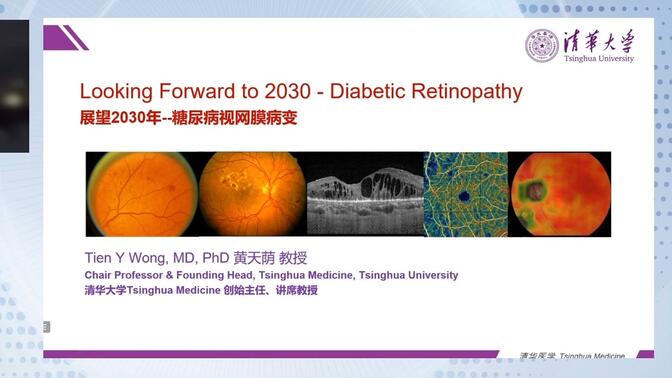 【直播回放】清华大学 黄天荫教授：展望2030--糖尿病性视网膜病变
