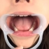 人体口腔舌苔检查