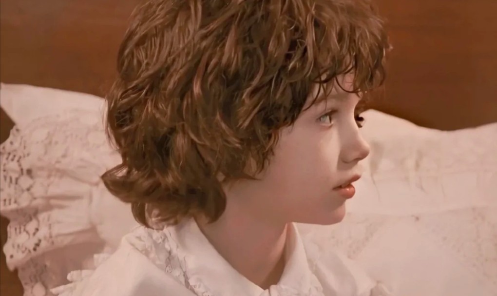 『鼻综合』鼻背|鼻尖|鼻小柱|山根|鼻翼|适配