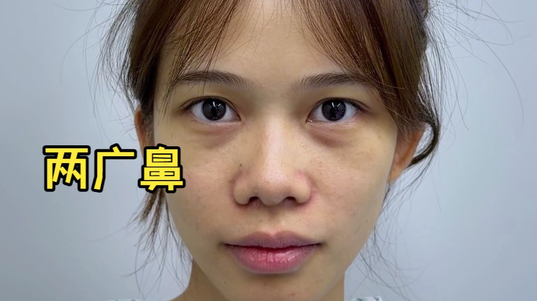 两广大眼萝莉coser 受不了自己的大宽鼻.....