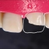 【4k高清】 令人惊叹的断裂牙齿修复